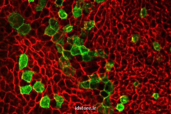 امید به درمان چاقی با كشف منبع سلول چربی قهوه ای و بژ