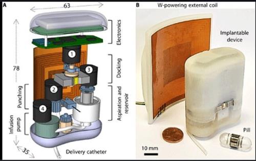 پمپ انسولینی که درون بدن قرار می گیرد و با کپسول خوراکی شارژ می شود!