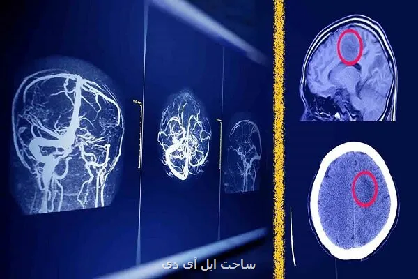 پیشبینی آینده رادیولوژیست ها باوجود هوش مصنوعی