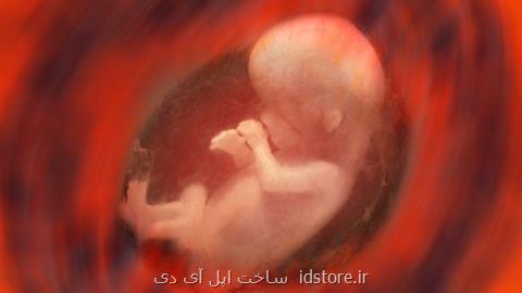 مكانیزم موثر در زایمان زودرس شناسایی شد