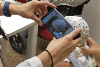 ارزیابی جمجمه نوزادان با تلفن همراه