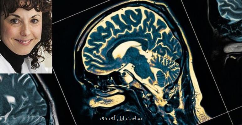 تشخیص چند دهه زودتر بیماری آلزایمر با یافته جدید دانشمند ایرانی
